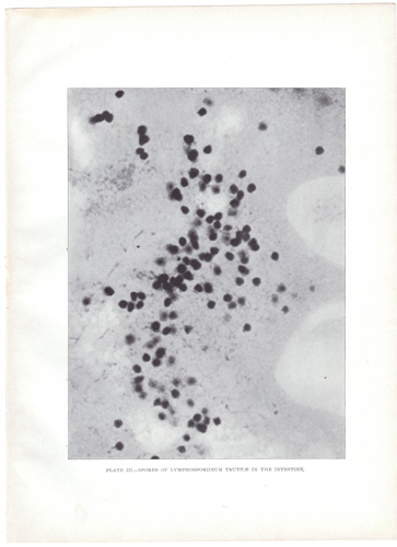 SPORES OF LYMPHOSPORIDIUM...